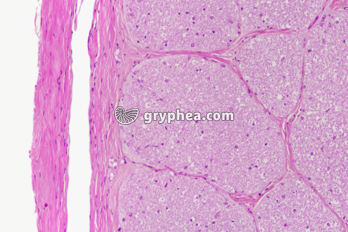 Nerf optique CT x25 - gryphea.com